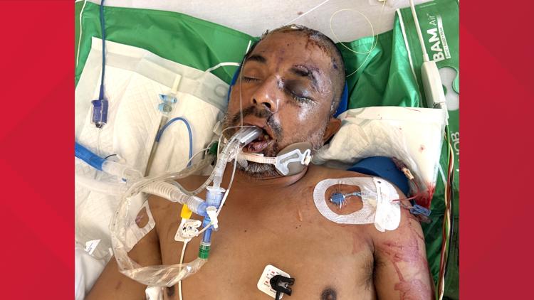 University Hospital asks for help identifying unconscious patient hit by truck Saturday evening — KENS 5 (San Antonio), Edina Health news